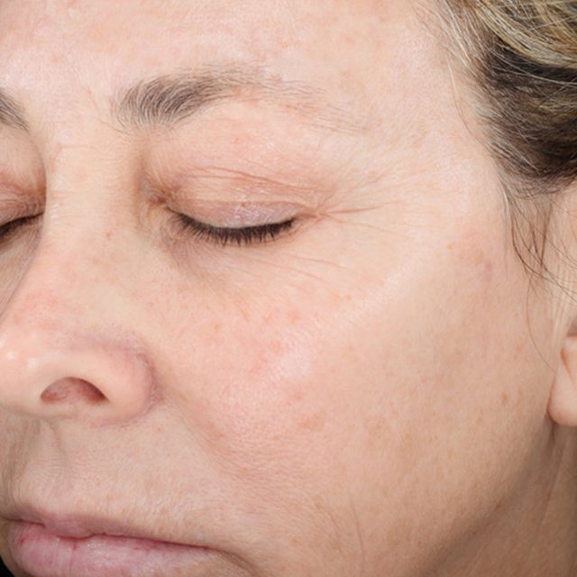 Closeup of left side of a woman's face region.