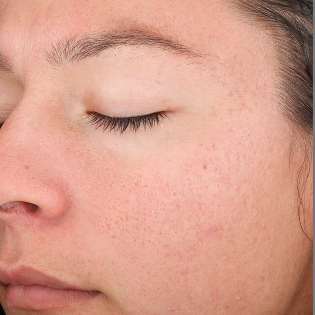 Closeup of left side of a woman's face region.