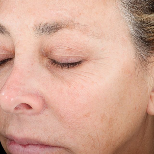Closeup of left side of a woman's face region.