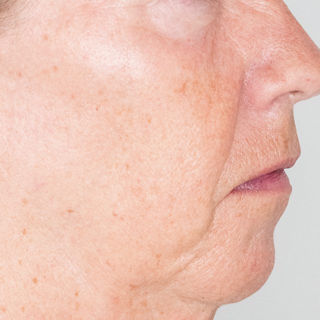 Head, Person, Face