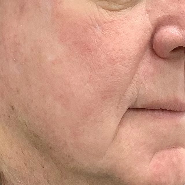 Person, Skin, Head