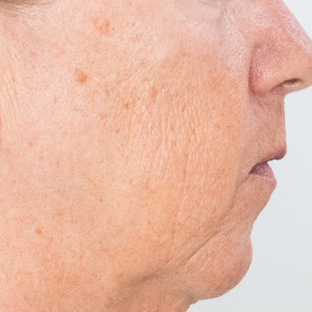 Head, Person, Face