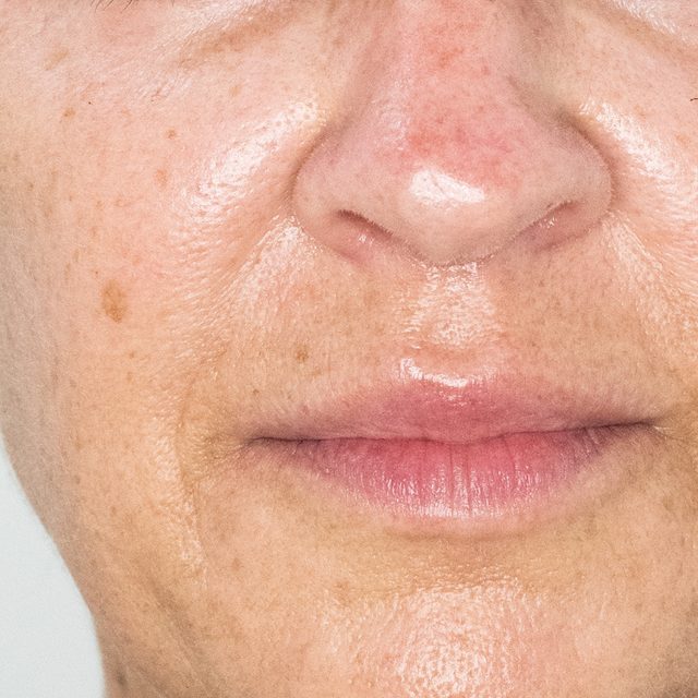 Person, Skin, Head
