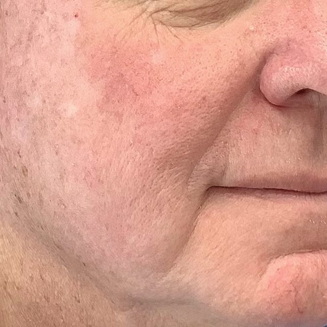 Head, Person, Face