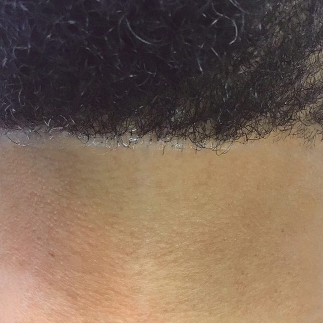 Body Part, Face, Head