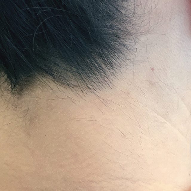 Body Part, Face, Head