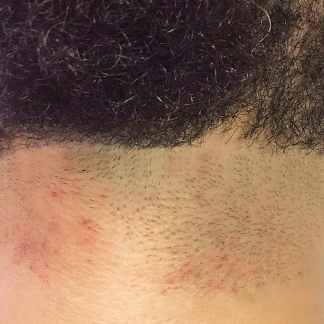 Body Part, Face, Head