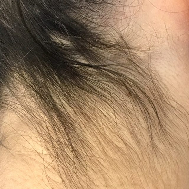 Body Part, Face, Head