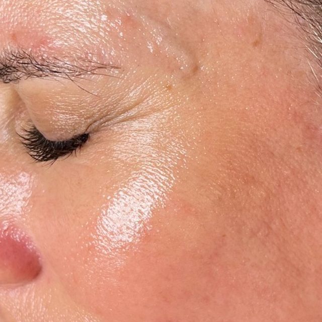 Person, Skin, Face