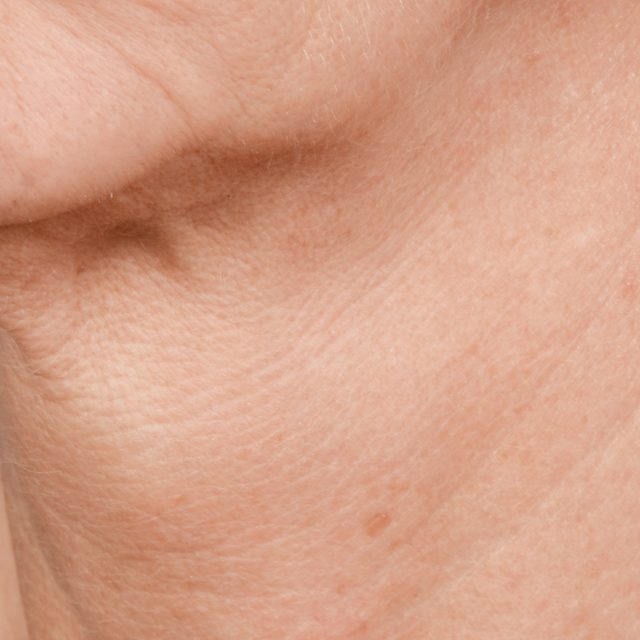 Body Part, Face, Head