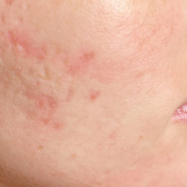 Person, Skin, Body Part