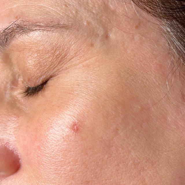 Person, Skin, Face