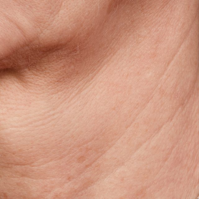 Body Part, Face, Head