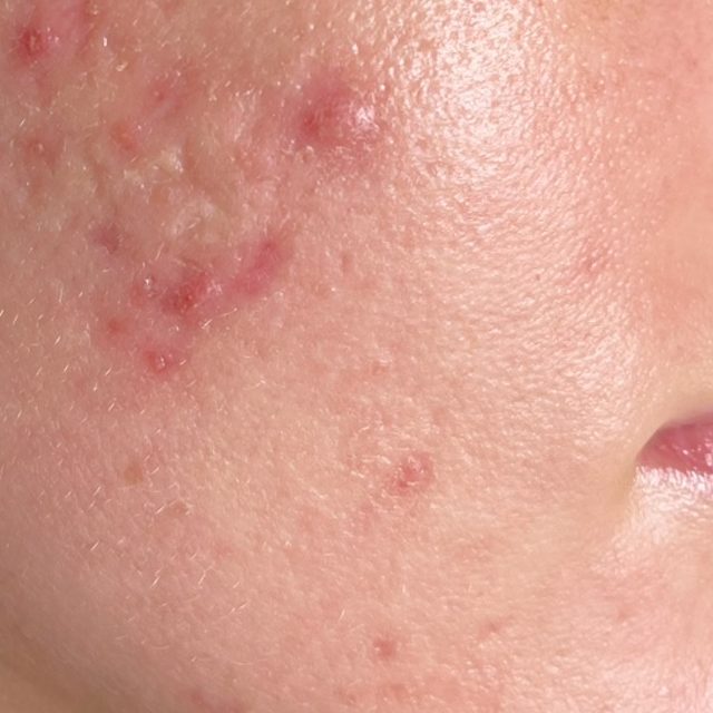 Person, Skin, Body Part