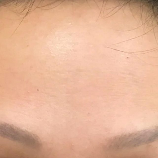 Person, Skin, Face