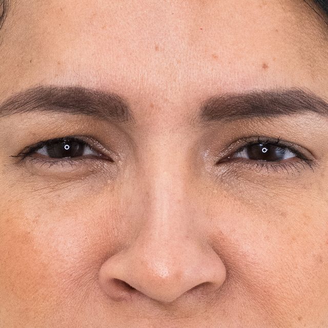 Person, Skin, Adult