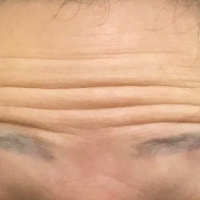 Head, Person, Face