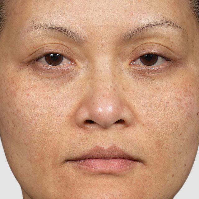 Head, Person, Face