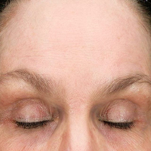 Person, Skin, Face