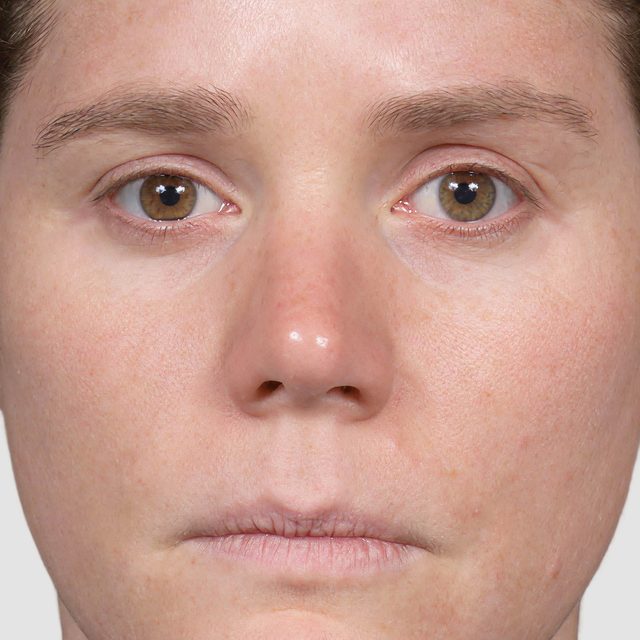 Person, Skin, Head