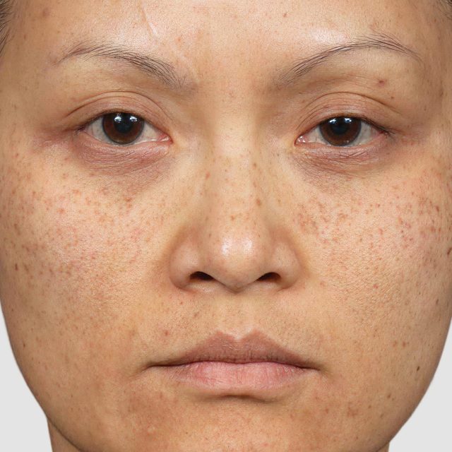 Head, Person, Face