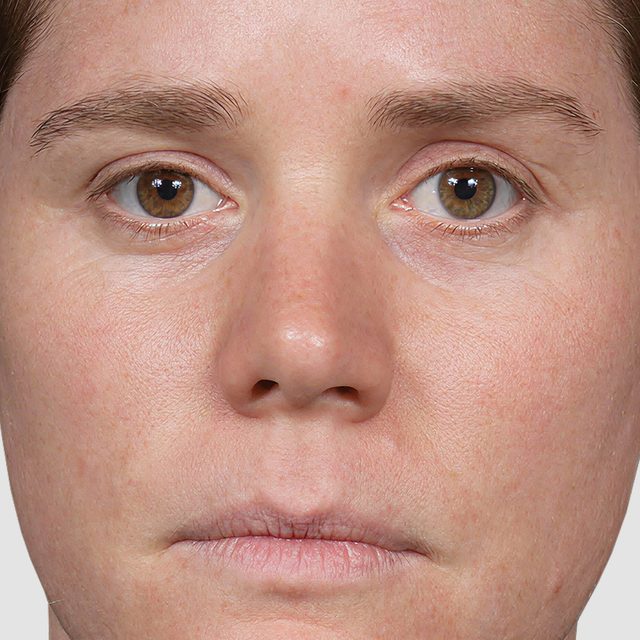 Person, Skin, Head