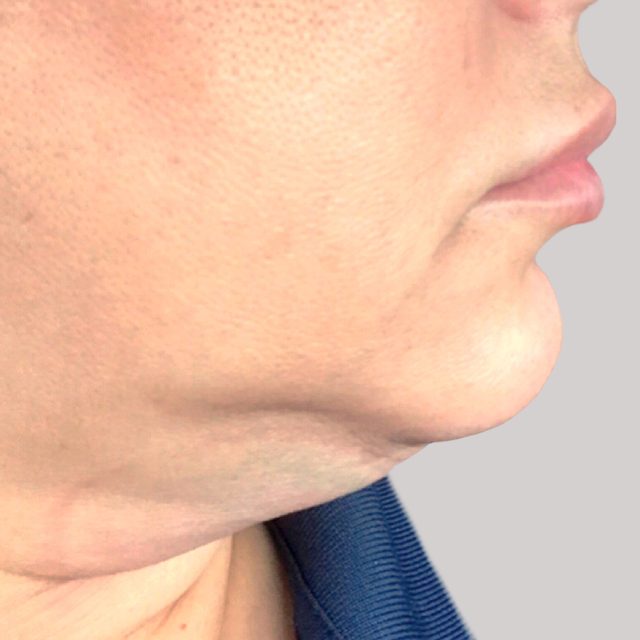 Head, Person, Face