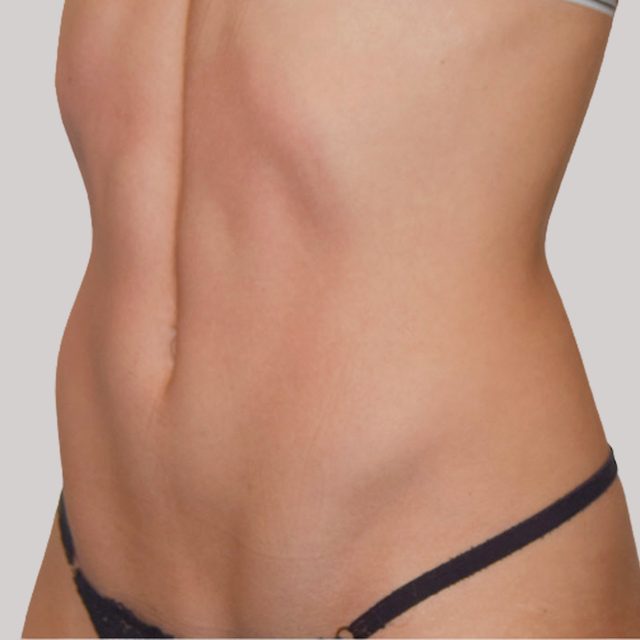 Clothing, Underwear, Lingerie