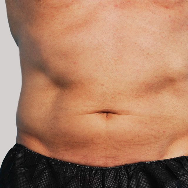 Person, Skin, Body Part