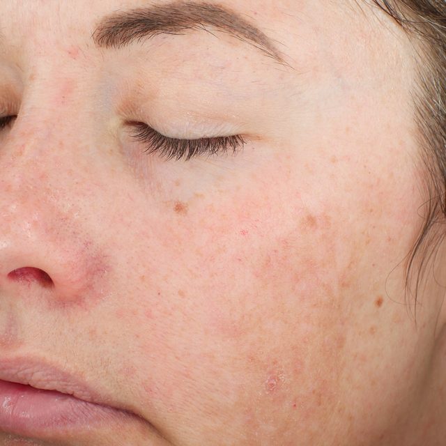 Person, Skin, Head