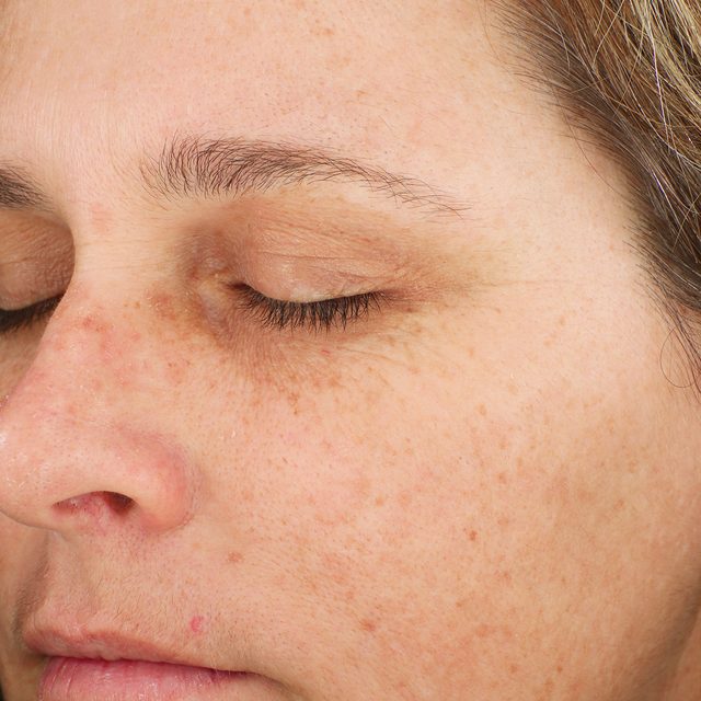 Person, Skin, Head