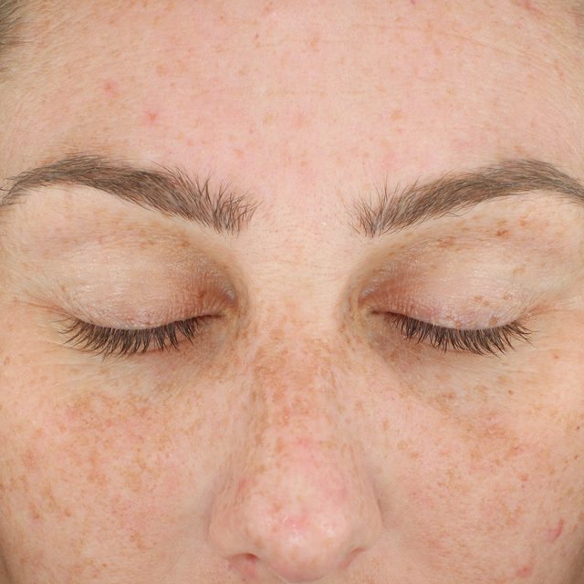 Person, Skin, Head