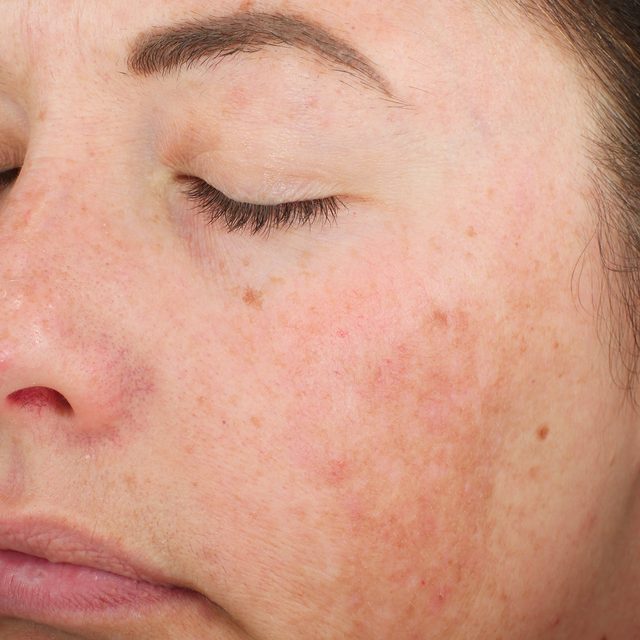 Person, Skin, Head