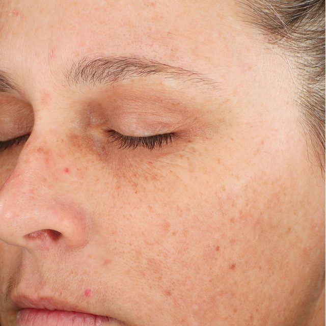 Person, Skin, Head