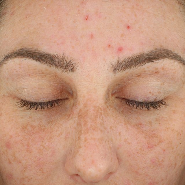 Person, Skin, Head