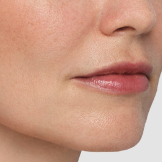 Person, Skin, Face