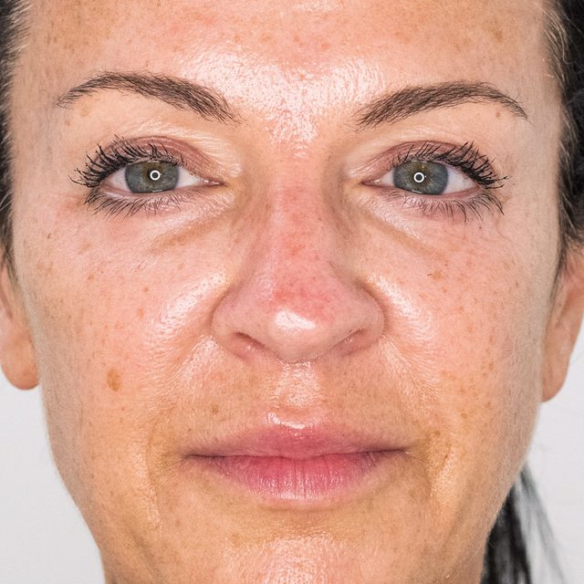 Person, Skin, Head