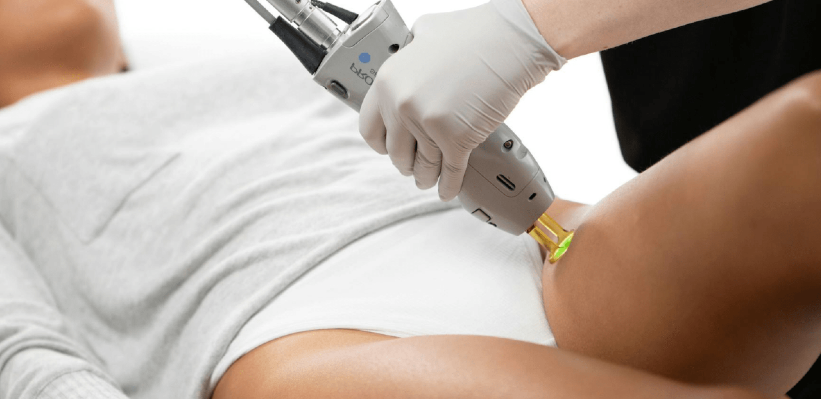 Laser Hair Removal Procedure