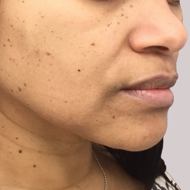 Head, Person, Face