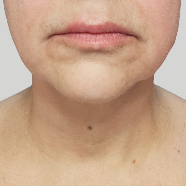 Head, Person, Face