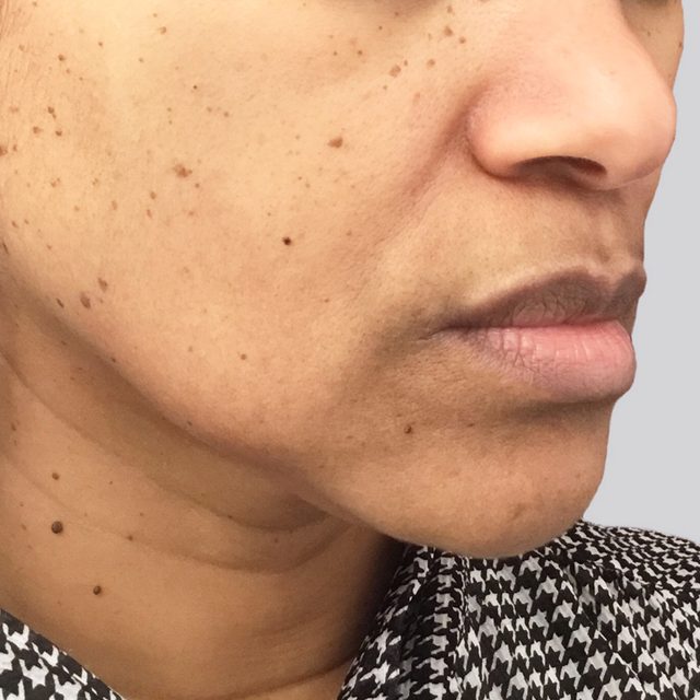 Head, Person, Face