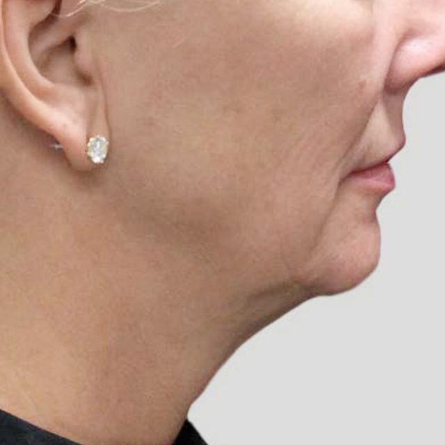 Accessories, Earring, Jewelry