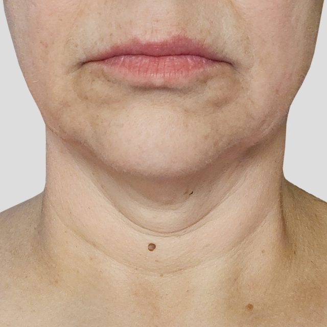 Head, Person, Face